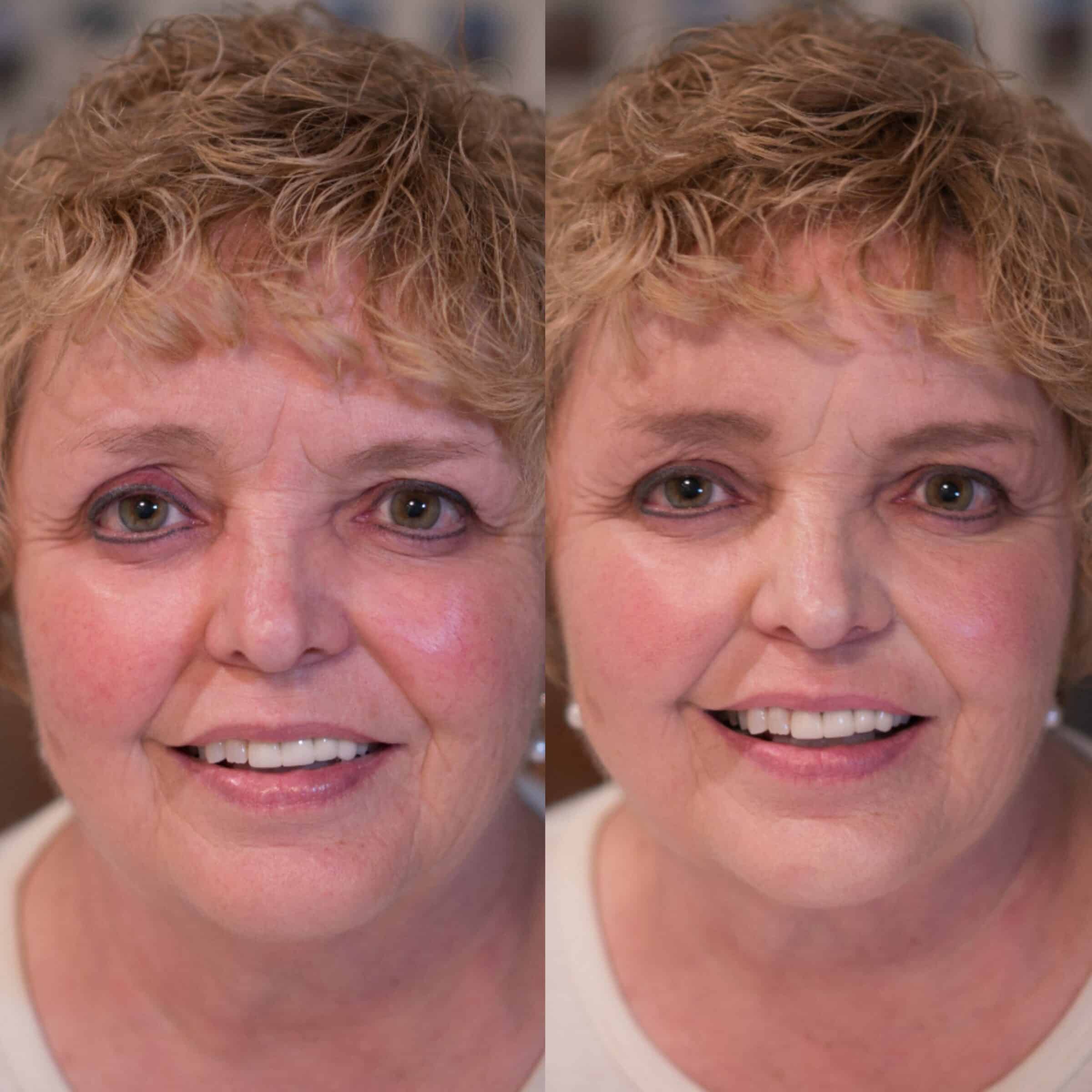 Lovely Before & After using Maskcara Makeup at www.maskcarabeautygirl.com
