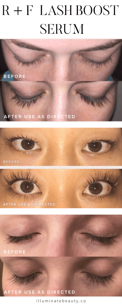 Rodan and Fields Lash Boost Product Reviews