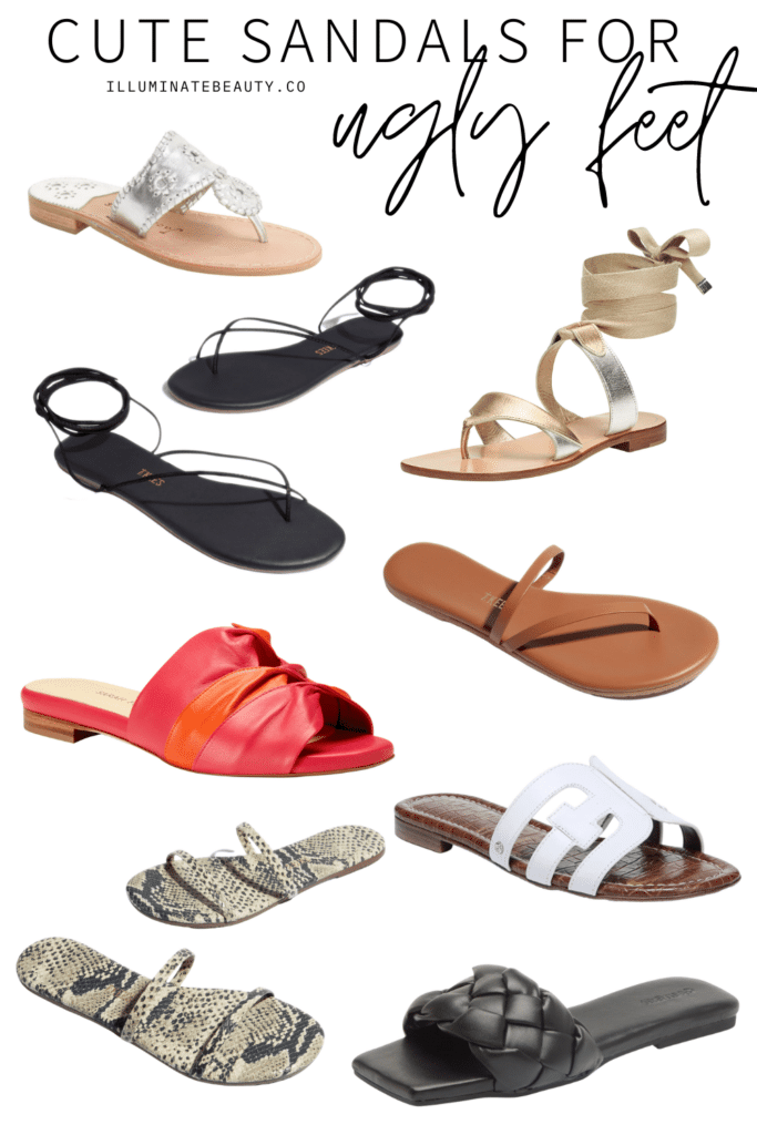 Ugly toes hot sale in sandals